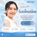 ร้อยไหมเงี่ยง 6 เส้น (Chin Thread Lift 6 Threads)
