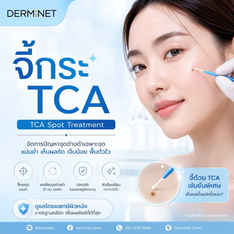 จีกระ TCA(30) (TCA 30% Freckle Spot Treatment)